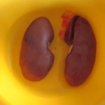 ledviny z prasete